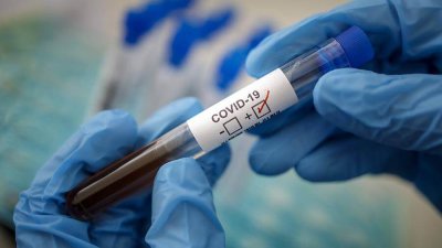 Роспотребнадзором создан новый тест для диагностики на коронавирус